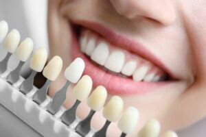 Choosing New Teeths | Wellington Point Dental Dental Implants